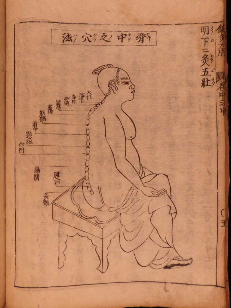 Image of 1699 Japanese Acupuncture Illustrated Woodblock Medicine Shinkyu Bassui Taisei