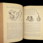 1882 GROSS Anatomy & Surgery System Medicine Pathology Therapy Engraving 2v Set