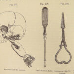 1882 GROSS Anatomy & Surgery System Medicine Pathology Therapy Engraving 2v Set