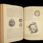 1882 GROSS Anatomy & Surgery System Medicine Pathology Therapy Engraving 2v Set