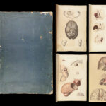 1829 Anatomy & Pathology ATLAS 86 Color Illustrated Disease Cruveilhier Medicine