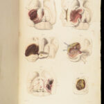 1829 Anatomy & Pathology ATLAS 86 Color Illustrated Disease Cruveilhier Medicine