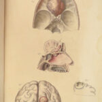 1829 Anatomy & Pathology ATLAS 86 Color Illustrated Disease Cruveilhier Medicine