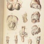 1829 Anatomy & Pathology ATLAS 86 Color Illustrated Disease Cruveilhier Medicine