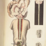 1829 Anatomy & Pathology ATLAS 86 Color Illustrated Disease Cruveilhier Medicine