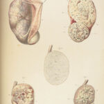 1829 Anatomy & Pathology ATLAS 86 Color Illustrated Disease Cruveilhier Medicine