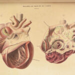 1829 Anatomy & Pathology ATLAS 86 Color Illustrated Disease Cruveilhier Medicine