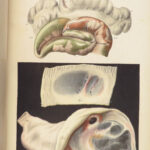 1829 Anatomy & Pathology ATLAS 86 Color Illustrated Disease Cruveilhier Medicine