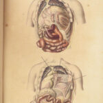 1829 Anatomy & Pathology ATLAS 86 Color Illustrated Disease Cruveilhier Medicine