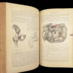 1893 Henry Gray GRAY’S ANATOMY Human Surgery Illustrated Medicine Physician