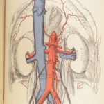 1893 Henry Gray GRAY’S ANATOMY Human Surgery Illustrated Medicine Physician