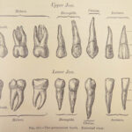 1893 Henry Gray GRAY’S ANATOMY Human Surgery Illustrated Medicine Physician