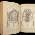 1893 Henry Gray GRAY’S ANATOMY Human Surgery Illustrated Medicine Physician