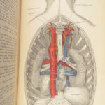 1893 Henry Gray GRAY’S ANATOMY Human Surgery Illustrated Medicine Physician