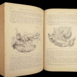 1893 Henry Gray GRAY’S ANATOMY Human Surgery Illustrated Medicine Physician