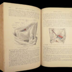 1893 Henry Gray GRAY’S ANATOMY Human Surgery Illustrated Medicine Physician