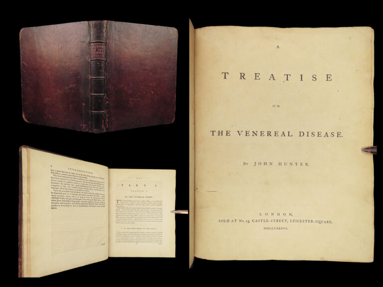 Image of 1786 Hunter Venereal Diseases 1ed Surgery Urology English Illustrated Medicine