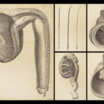 1786 Hunter Venereal Diseases 1ed Surgery Urology English Illustrated Medicine