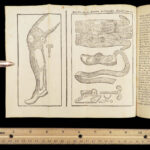 1759 BONE Diseases Surgery Petit French Medicine Malady des Os Illustrated 2v