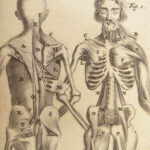 1695 ANATOMY Medicine Surgery Dutch Steven Blankaart Illustrated Skeleton Latin